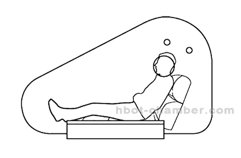 1.5 ATA Monoplace Sitting Mild Hyperbaric Oxygen Chamber for Wellness