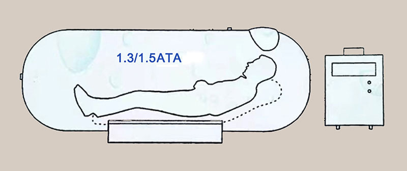 Home Use 1.5 ATA Portable Hyperbaric Oxygen Chamber for Sale